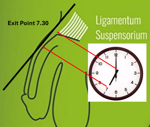 Exit Point Example How to Determine My Exit Point – Penis Enlargement Guide
